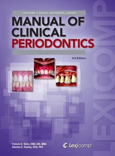 Read Manual Of Clinical Periodontics A Reference Manual For Diagnosis  Treatment Lexi Comps Dental Reference Library By Francis G Serio