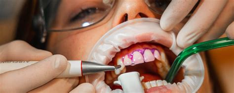 Manuale clinico di igiene e terapia dentale. - Home wiring system guide free download.