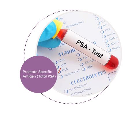Marafiq vendor registration.  When total prostate-specific antigen (PSA) concentr...