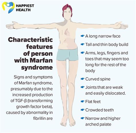 Marfan syndrome porn. .  <a href=https://stpoint.ru:443/baawv6/makeblock-mbot-robot...
