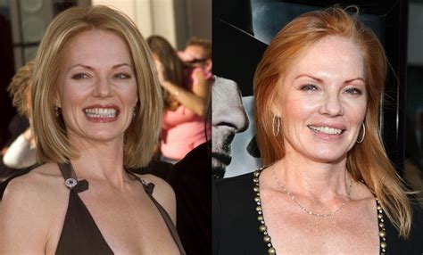 More about Marg Helgenberger Plastic Surgery Before and After. Celebrities set the trends and are at the forefront of the beauty industry. They use the most modern beauty treatments and cosmetic products. Beauty treatments, makeup and hair can enhance them in incredible ways. And so can cosmetic or plastic surgery. Some cosmetic surgery ....