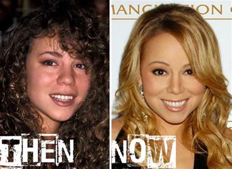 Mariah carey rhinoplasty. 24-nov-2014 - Mariah Carey's nose job is a perfect example of subtle changes making huge differences, as seen by her altered nose and cheeks. ... Rhinoplasty Surgery. Nose Surgery. Celebrities Then And Now. Celebrities Before And After. Botox. Facial Anatomy. Celebrity Plastic Surgery. Reconstructive Surgery. 