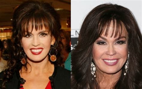 Marie Osmond reveals she underwent breast reduction surgery in her 20s to ease her back pain and avoid looking like a human zipper. She also talks about her career and her co-host Julie Chen's plastic surgery story.. 