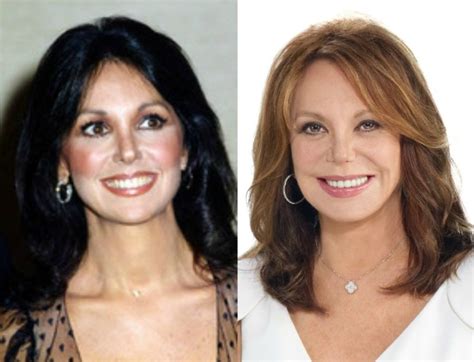 Marlo thomas and plastic surgery. The rumors about Marlo Thomas' plastic surgery became widespread when fans noticed the now 85-year-old actress was not aging. While some fans think Marlo Thomas' plastic surgery journey began before she started filming the "That Girl" sitcom, others think Thomas' need for surgery came after her appearance on the sitcom. 