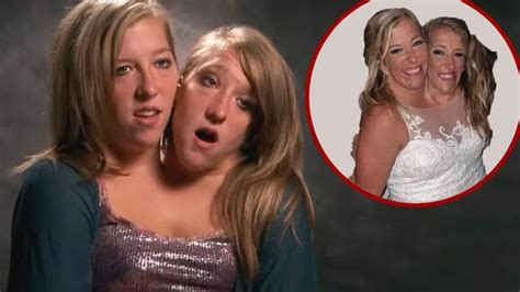 Abby and Brittany Hensel as babies / YouTube. Abby and Brittany Hensel learned together what worked and what did not. Simple traits made a world of difference and still do for the twins. For example, Abby is taller than Brittany. In fact, Abby’s spine needed operating on so it would stop growing after Brittany’s had stopped.. 