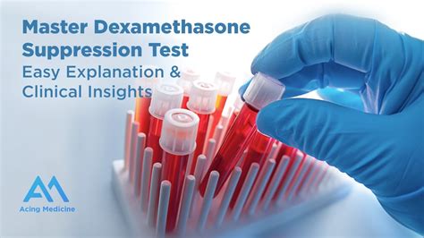 Master Dexamethasone Suppression Test Easy Explanation & Clinical