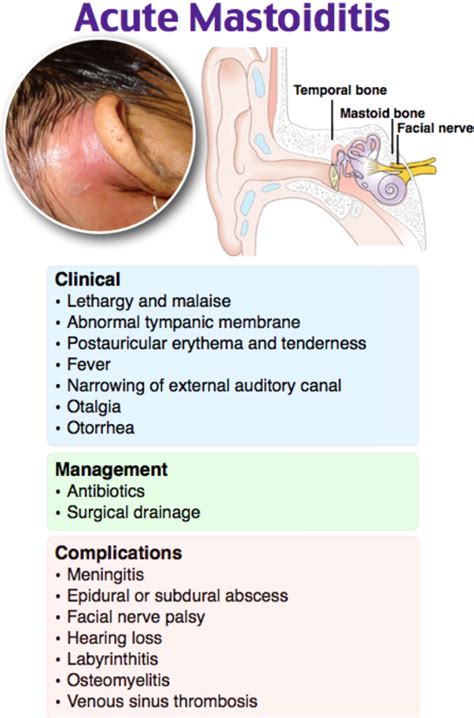 Mastoiditis in child treatment