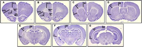 Maternal Preconception Stress Alters Prefrontal Cortex ... - PubMed