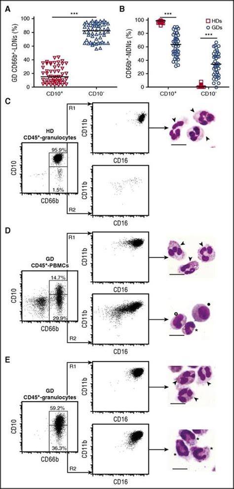 Mature CD10+ and immature CD10− neutrophils present in G