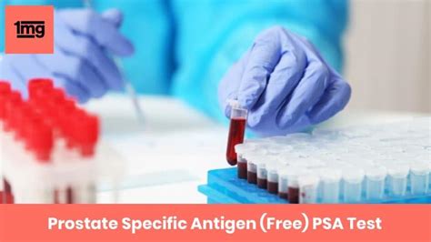 Measurement of total and free prostate specific antigen …