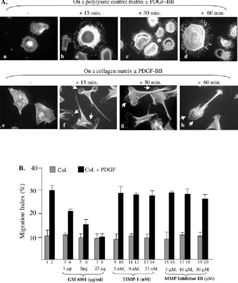 Mechanism of Human Dermal Fibroblast Migration Driven by Type …