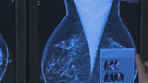 MedWatch Daily Digest: A new gene discovery for breast cancer – and more