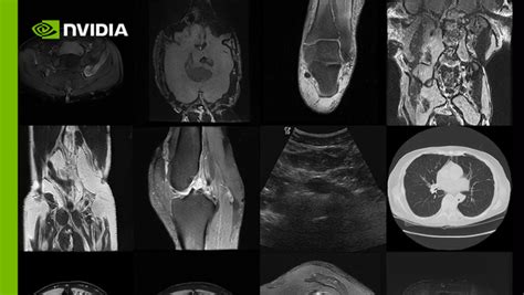 Medical Imaging Data A Clear And Concise Reference