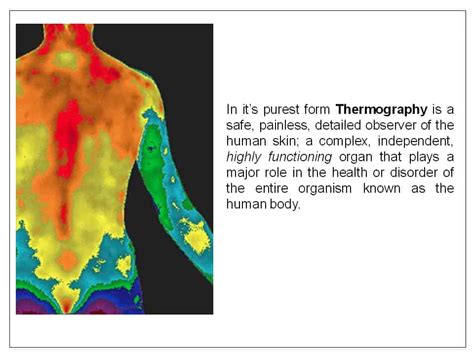 Medical Thermography Albany NY Medical …