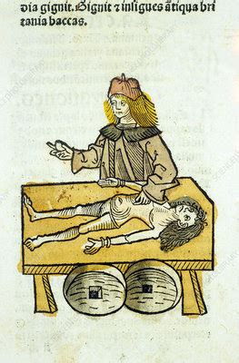 Medieval Surgery - British Library