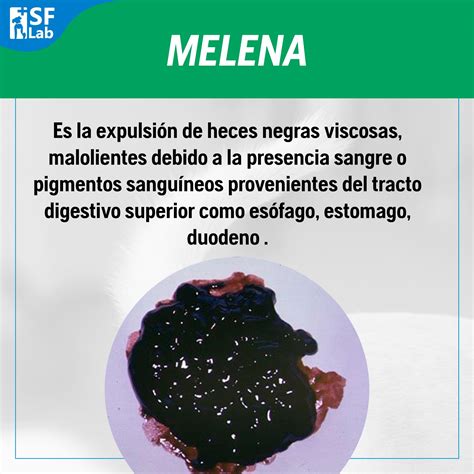 Melena Onlyfans Leak