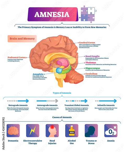 Memory loss (amnesia) - NHS