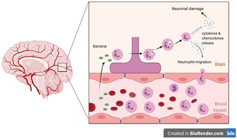 Meningitis due to - ScienceDirect