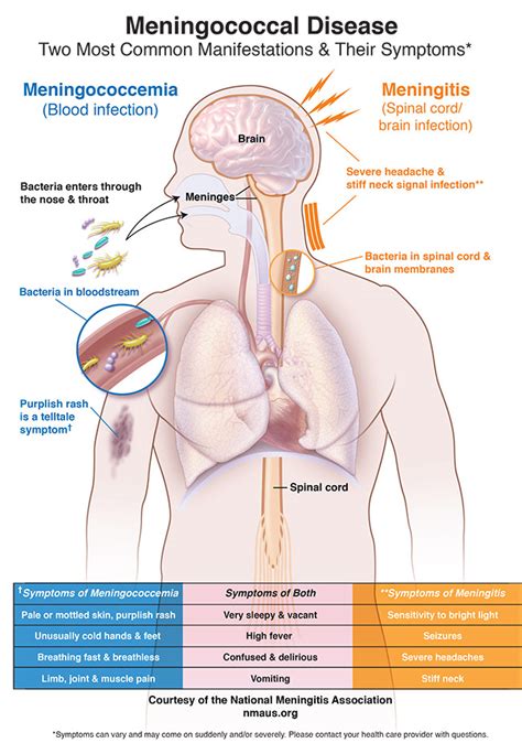 Meningococcal Disease