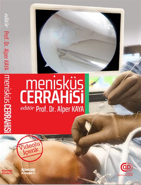 Menisküs Cerrahisi.