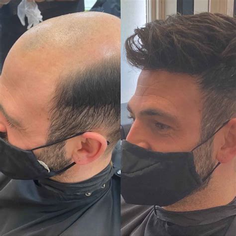 Mens hair systems. A system is used to fill in areas of hair loss, allowing you to achieve your desired look of a full head of hair. Hair systems are made of 2 materials called polyurethane or lace, however the systems can be made with both materials. Human hair is knotted or injected into the material which then creates the hair system. 