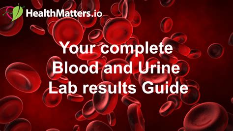 Mercury, Urine - Lab Results explained HealthMatters.io