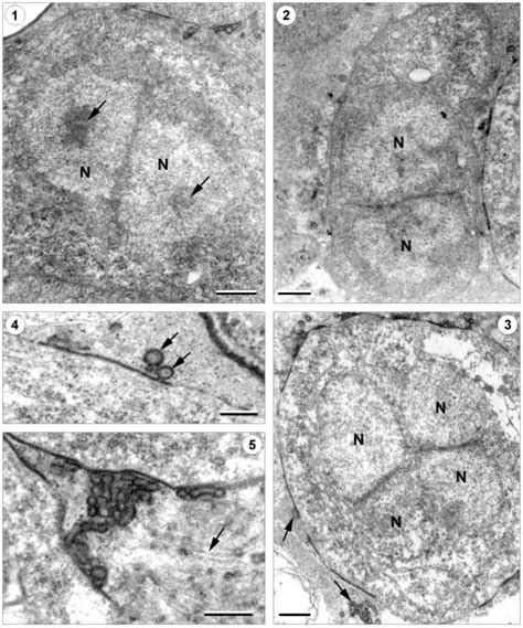 Merogony and early sporogony of Nosema artemiae. 1 -rounded …