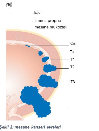 Mesane Kanseri Title.