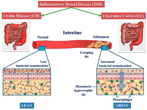 Mesenteric Fat and Intestinal Muscle Interface: Creeping Fat ...