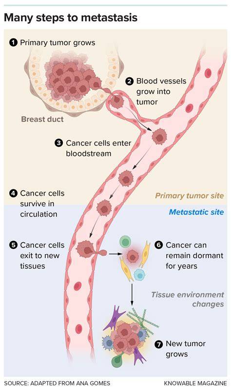 Metastasis