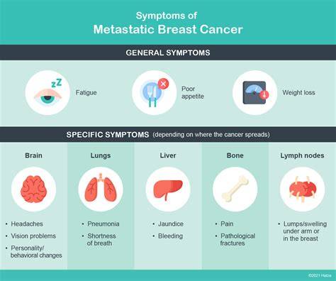Metastatic Breast Cancer