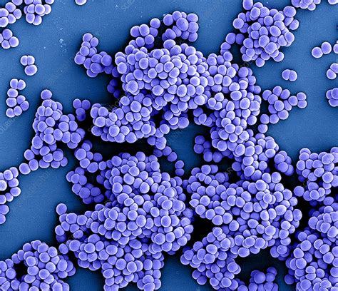 Methicillin-Resistant Staphylococcus aureus - StatPearls