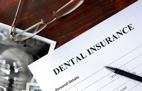 7/17/2023. Metlife FedVip Dental Insurance is an absolute scam