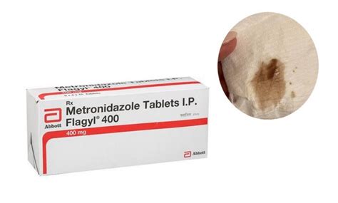 Metronidazole clumpy discharge. Trichomonas is treated either with metronidazole (Flagyl) or tinidazole (Tindamax), given by mouth in a single dose. · Chlamydia · Vaginal yeast infections ... 