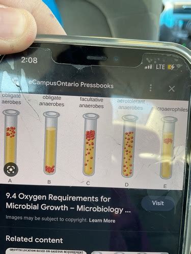 Microbiology 29 Flashcards Quizlet