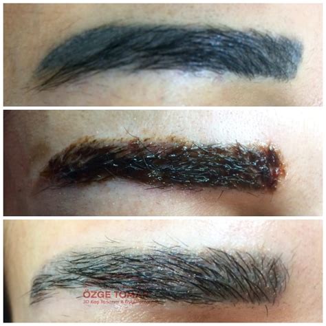 Microblading sildirme
