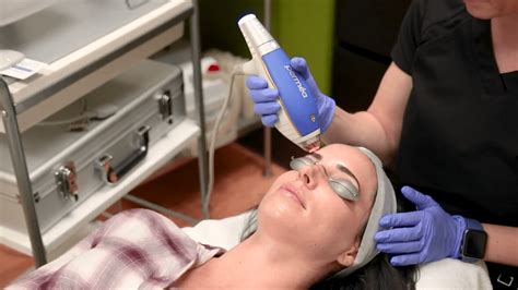 Microdermabrasion San Diego Crystal Free …