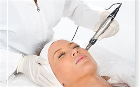 Microneedling CS Beauty