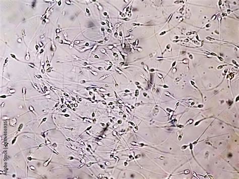 Microscope for sperm analysis.  This section outlines the significance of microsco...