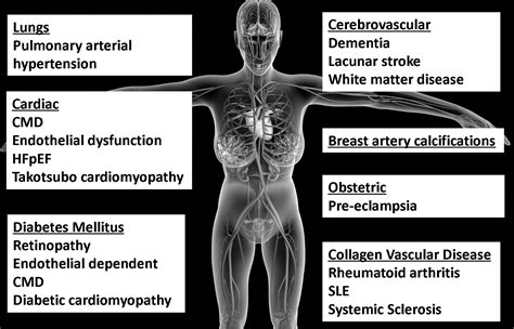 Microvascular Coronary Disease (Small Vessel Disease) - Cleveland Clinic