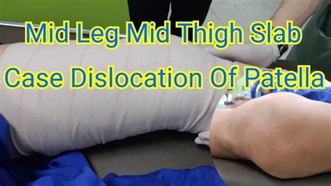 Mid Leg Mid Thigh Slab #:Lat. Dislocation of Patella - YouTube