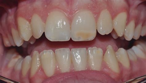 Mih&aacute;ly K&aacute;rolyi (March 4, 1875 &mdash; March 19, 1955), Hungarian ...