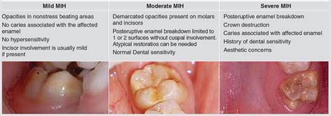 Mih.Brizza Leaks XxX 🍑