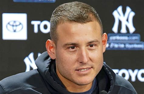 Mike Lupica: Yankees should have their eyes checked over handling of Anthony Rizzo’s concussion