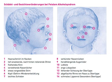 Mikrozirkulationsstörungen und diapedeseblutungen im fetalen gehirn bei hypoxie. - Answers to exploring psychology study guide.
