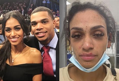 Miles.bridges wife nude. MILES Bridges' wife has appeared to have shared a series of graphic images of her injuries online after the NBA star was arrested. Mychelle Johnson claimed she suffered a fractured nose, wrist, and concussion. 2. Mychelle Johnson claims she suffered a fractured nose and wrist Credit: Instagram/@thechelleyj. 2. 