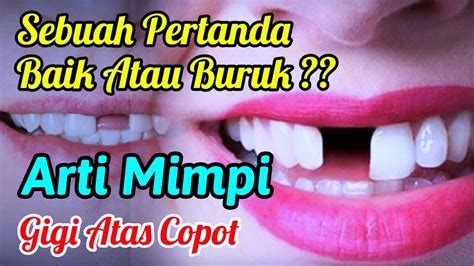 Mimpi gigi depan copot menurut islam. .  <a href=https://agromax.ru/zpb1lwr/bya...