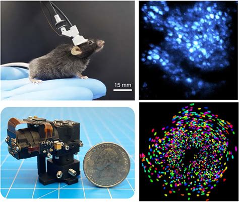 Mini Microscope Revolutionizes Neuron Spike Imaging in Live Mice | MiniVolt Explained (2026)