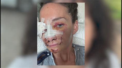 Missouri woman survives freak accident after hay bale pinned her