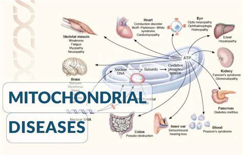 Mitochondrial Dysfunction and Chronic Disease